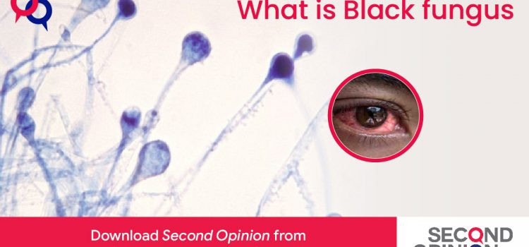 What is Black fungus & the need of doctors consultation?
