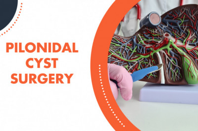 Do Kids Need Pilonidal Cyst Surgery?