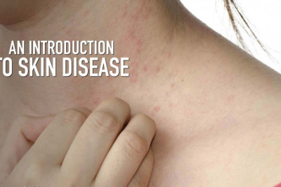 Skin Problems - Herbal Medicine for Skin Diseases