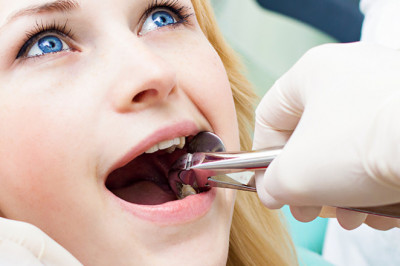 Painless wisdom tooth extraction at Dental Roots- Visit us now!