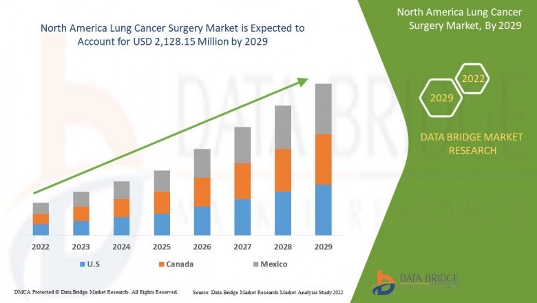 North America Lung Cancer Surgery Market Global Trends | Gadget