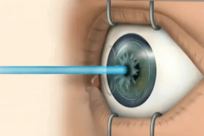 Your Best Vision Guide: Look at the Best Surgery Options!