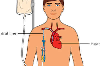 Parenteral Nutrition Market Analysis: Key Drivers, Challenges, and Opportunities